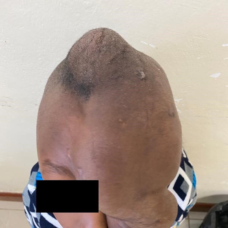 Pre-Surgery_2