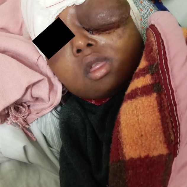 Post-Surgery_1